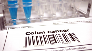 Etiqueta de prueba médica con la inscripción “Colon cancer” junto a tubos de ensayo con muestras en un laboratorio, en el contexto del cribado del cáncer colorrectal.