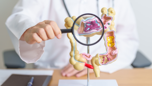 Médico sosteniendo una lupa sobre una maqueta 3D del órgano colorrectal, simbolizando la exploración y detección temprana del cáncer colorrectal.