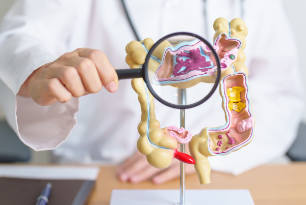 Médico sosteniendo una lupa sobre una maqueta 3D del órgano colorrectal, simbolizando la exploración y detección temprana del cáncer colorrectal.