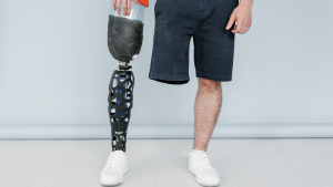 Persona con prótesis de pierna moderna en posición de pie, mostrando el diseño tecnológico de la prótesis.