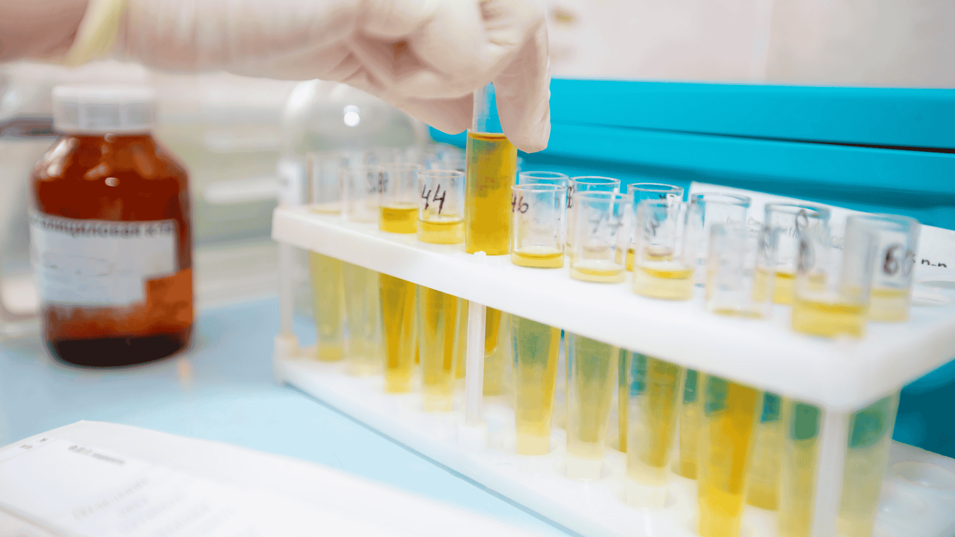 Muestras de orina en tubos de ensayo en un laboratorio, utilizadas en la investigación de biomarcadores para cáncer de vejiga y urológico superior.