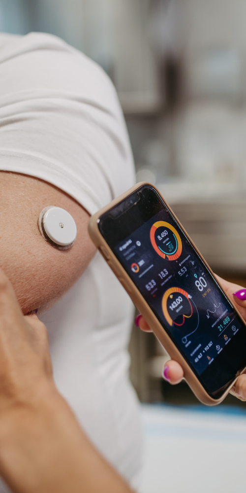 Persona utilizando un sensor en el brazo para monitorizar su glucosa y consultando los datos en una aplicación móvil, como parte del control de la diabetes.