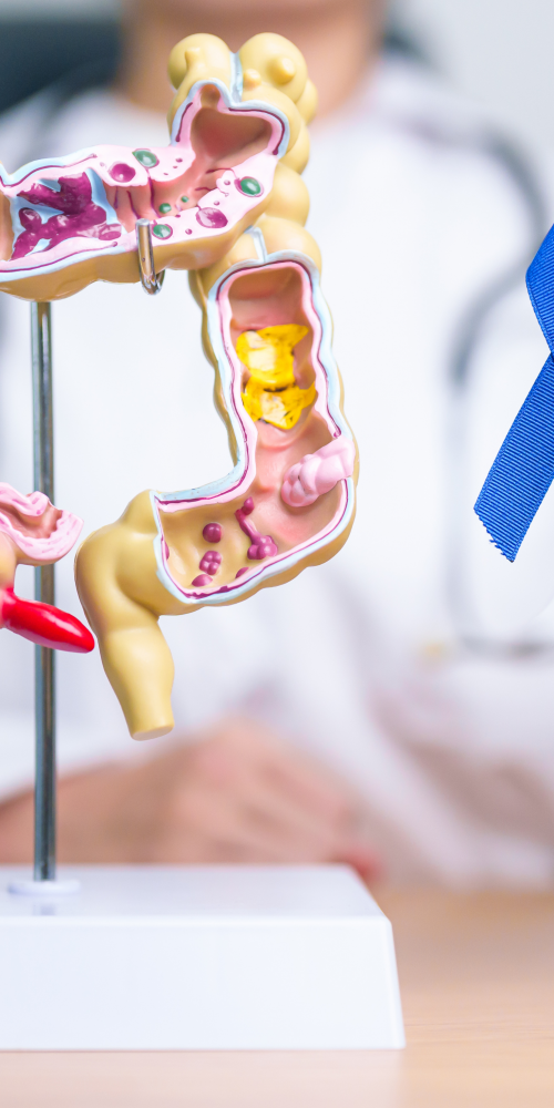 Modelo anatómico del colon sobre una mesa y profesional sanitario sosteniendo un lazo azul como símbolo de concienciación sobre el cáncer colorrectal y su detección precoz.