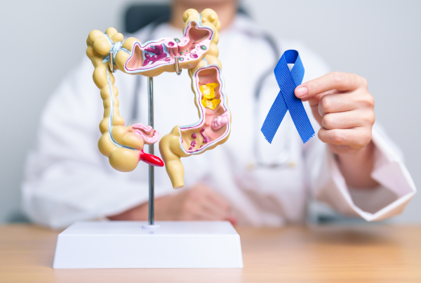 Modelo anatómico del colon sobre una mesa y profesional sanitario sosteniendo un lazo azul como símbolo de concienciación sobre el cáncer colorrectal y su detección precoz.